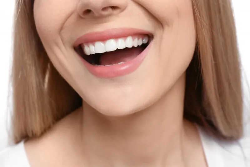 Image Hannah image beautiful image beautiful image beautiful image beautiful image beautiful image beautiful image beautiful image beautiful image beautiful - Non-Cosmetic Reasons to Consider Veneers : Hannah Baek, DDS: Dentist