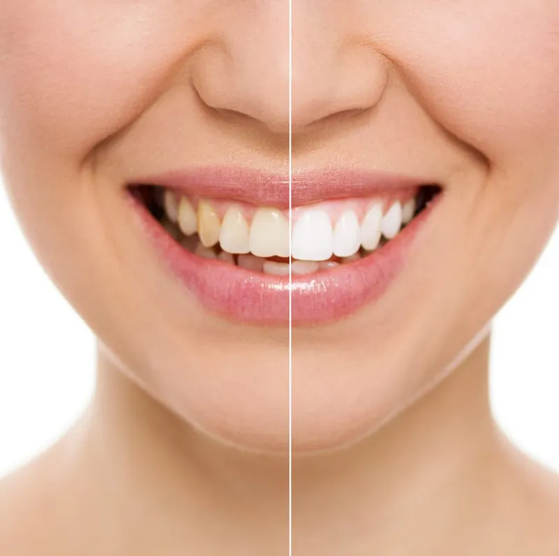 Image Jeremy image beautiful image beautiful image beautiful image beautiful - Beautiful Smiles | Cosmetic Dentistry in Gresham | Dr. Jeremy ...