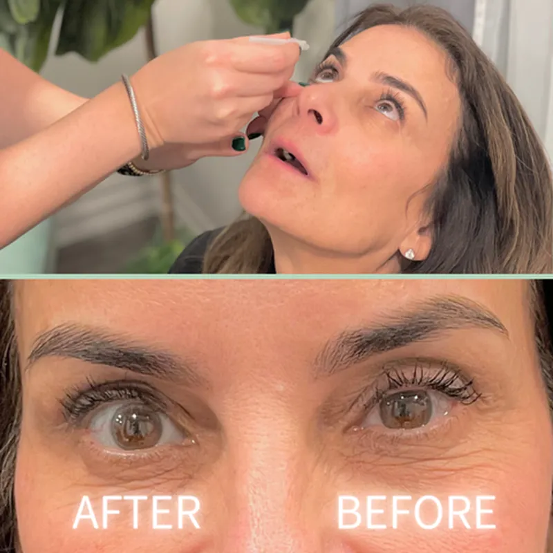 Image Left Eye image beautiful image beautiful image beautiful - Introducing an Amazing Treatment for Beautiful, Bright Eyes – Mint ...