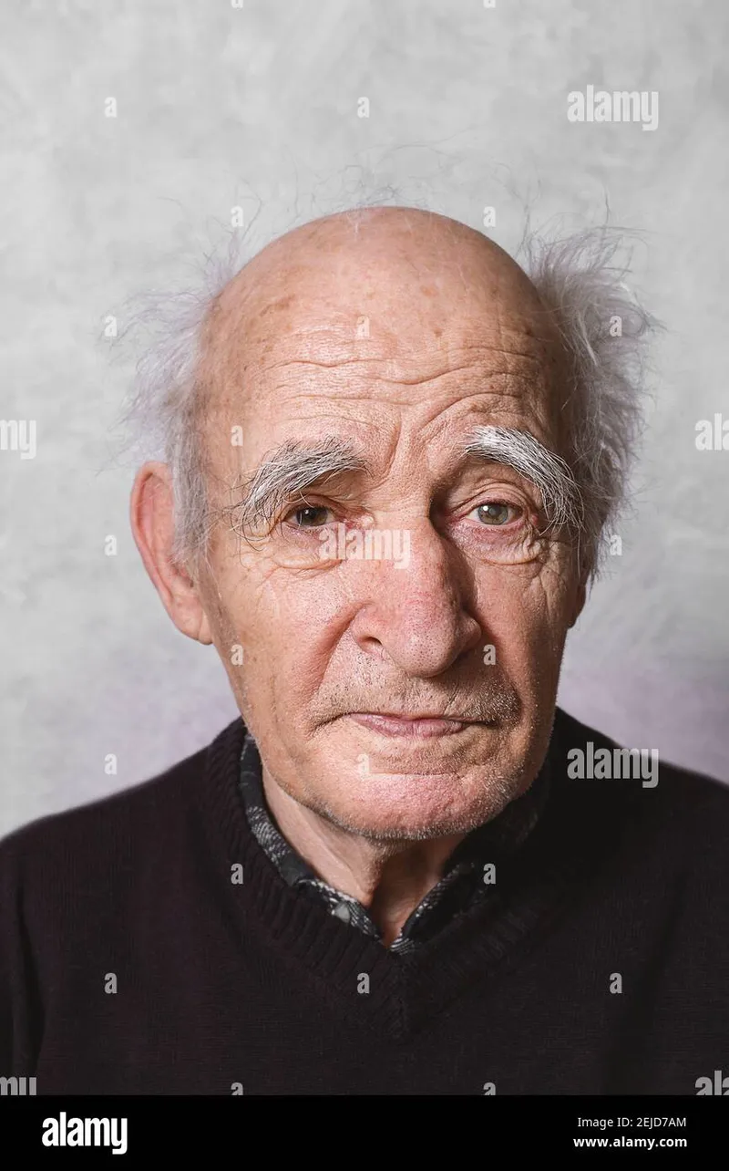 Image Left Eye image beautiful image beautiful image beautiful - Elderly man portrait. Close up. Glaucoma in left eye. Getting Old ...