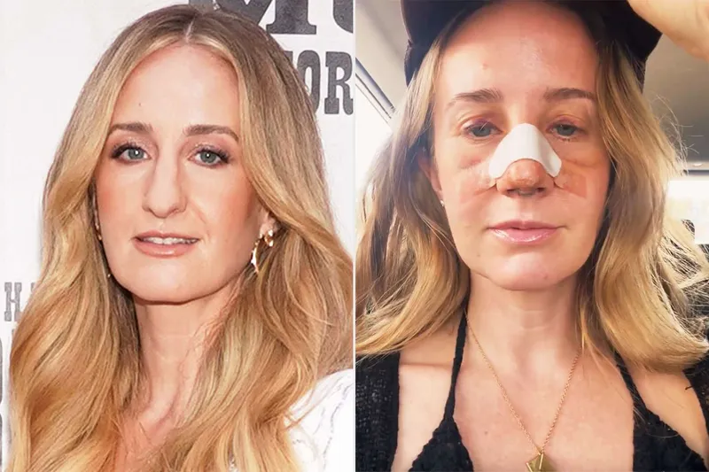 Image Margo Price image beautiful - Why Country Singer Margo Price Got a Nose Job: 'I Was Bullied ...